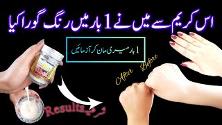 Skin Whitening home Remedies  Hands Feet Whitening DIY  Skin Care DIY Facial at home [upl. by Adnole]