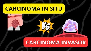 Carcinoma in situ versus Carcinoma invasor [upl. by Enrika]