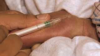 Newborn Care Series Giving an Intradermal Injection [upl. by Avad]