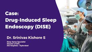 Case DrugInduced Sleep Endoscopy DISE by Dr Srinivas Kishore S  Sleep Specialist AIG Hospitals [upl. by Atwood]