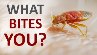 Guide to the bites how to identify what insects are biting you at your home [upl. by Dnalkrik]