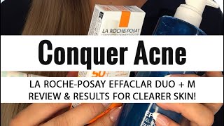 Ultimate Review La Roche Posay Effaclar Duo M Unveiled  Is it Worth the Hype [upl. by Eleynad]