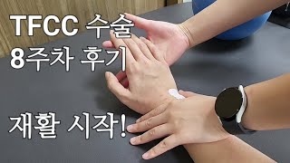 TFCC 수술 환자 8주차 후기  일상생활 가능  재활운동 [upl. by Corrie]