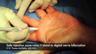 Live Surgery Digital Block Anesthesia of the Finger [upl. by Gomer]