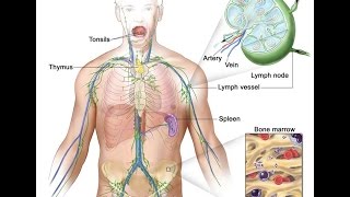 Hodgkin Lymphoma [upl. by Constancia]