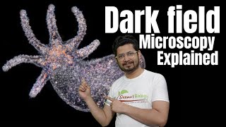 Dark field microscopy explained  Dark field microscope principle [upl. by Sperry]