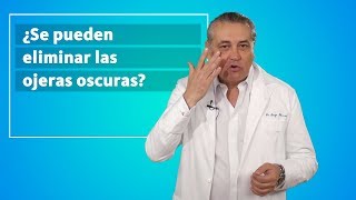 ¿Se pueden eliminar las ojeras oscuras  Corpore Sano [upl. by Earlene]