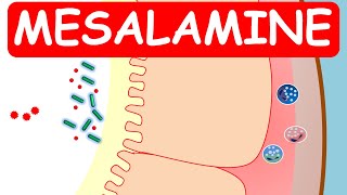 Mesalamine Pentasa ER capsules for ulcerative colitis [upl. by Nylarahs341]