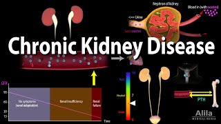 Chronic Kidney Disease Animation [upl. by Id884]