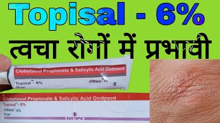 Topisal  6 Uses in Hindi  Clobetasol Propionate and Salicylic Acid Ointment [upl. by Newhall485]