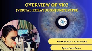 Vernal Keratoconjunctivits VKC VKC [upl. by Livy]