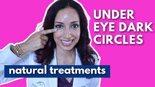 Eye Doctor Explains How To Get Rid Of Dark Under Eye Circles Naturally [upl. by Esihcoc200]