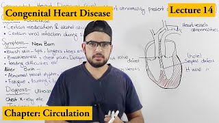 Congenital Heart Diseases Cardiovascular Disorders  Chapter Circulation video  14 [upl. by Relyhcs]