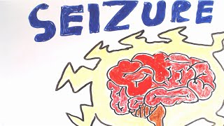 What are seizures [upl. by Mikel]