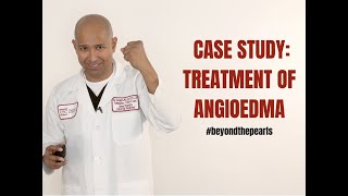 Treatment of Angioedema Case [upl. by Alyal]