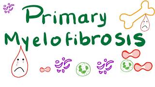 Primary Myelofibrosis PMF  Myeloproliferative Neoplasm Bone Marrow Fibrosis [upl. by Hope]