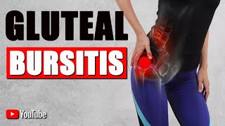 GLUTEAL BURSITIS BEST STRETCHES EXERCISES amp ADVICE for Hip Pain Relief [upl. by Pavier842]