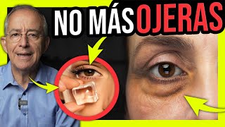 👁️ OLVIDATE De Las OJERAS Con SOLUCIONES EFECTIVAS Y NATURALES  Oswaldo Restrepo RSC [upl. by Nyraa]