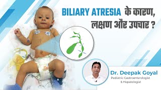 Biliary Atresia के कारण लक्षण और उपचार  Biliary Atresia Baby  Dr Deepak Goyal [upl. by Celtic]