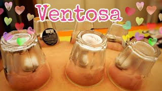 How to Ventosa at Home  Cupping Therapy  Ventosa Procedure [upl. by Lexerd]