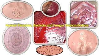 Human Parasites Bacteria and Fungus Demonstration [upl. by Fesoy]