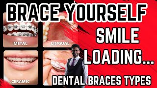 Dental braces  different types explained2020Invisalign [upl. by Selegna868]