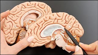 Brain Anatomy Cross Section Structures  MADE EASY  Part 3 of 5 [upl. by Ailimat644]