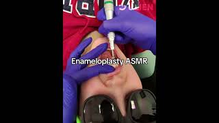 This Dental Procedure Will Tingle Your Senses [upl. by Vassaux]