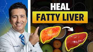 4 Steps To “Reverse” Insulin Resistance amp FATTY LIVER [upl. by Michigan]