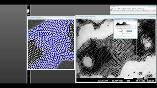 How to use ImageJ for nanoparticle size distribution analysis [upl. by Ziom65]