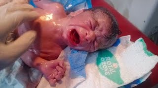 New born beautifull male baby rescue baby came with zero breath but after procedure baby cry thank💕😂 [upl. by Trebliw]