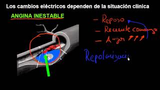 CURSO DE EKG 32  ELECTROCARDIOGRAFÍA DE LA CARDIOPATÍA ISQUÉMICA  INTRODUCCIÓN CLÍNICA [upl. by Noma813]