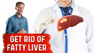 Reduce Your Liver Fat by 50 Percent in 14 Days [upl. by Nies12]