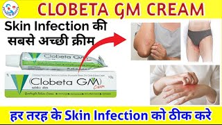 Clobeta gm CreamSkin Infection की सबसे अच्छी क्रीमpriyanshumedicosclobetasol neomycinsulphaye [upl. by Dolphin]