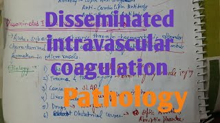 Disseminated Intravascular Coagulation DIC Pathology [upl. by Dnalra]