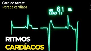 ECG EKG Ritmos cardíacos letales sinusal taquicardia bradicardia fibrilação parada cardíaca [upl. by Novick]