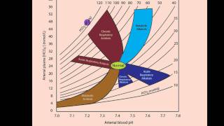 Part 2 Acidosis and Alkalosis Metabolic or Respiratorymp4 [upl. by Beyer927]