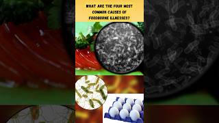 Which Are the 4 Most Common Causes of Foodborne Illnesses [upl. by Mieka]