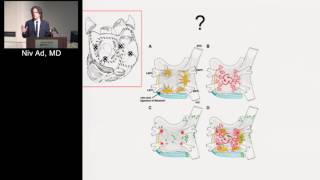 Surgical Treatment of Atrial Fibrillation Niv Ad MD Sep 15 2016 [upl. by Einberger]