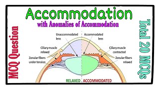 MCQ  Accommodation and its Anomalies [upl. by Eiuqnimod]