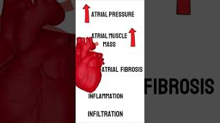 What causes Atrial Fibrillation medicine cardiology medical [upl. by Ahseka]