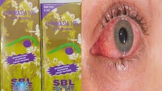 EUPHRASIA EYE DROPS  यूफ्रेसिया आंख का ड्रॉप हिंदी में  EUPHRASIA EYE DROPS IN HINDI [upl. by Atterahs]