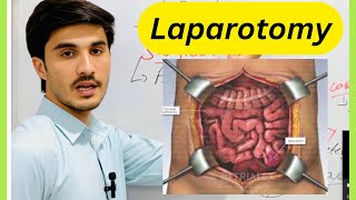 Laparotomy  Hindi  Urdu  Medico learning [upl. by Aynom249]