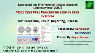 vdrl test principal and full procedure  Vdrl disease serological test in laboratory  vdrl test mlt [upl. by Valery504]