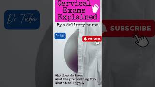 What do the Cervical Exam Numbers Mean pregnancy cervical pain [upl. by Portie745]