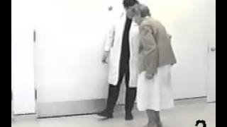 Parkinsonian shuffling gait [upl. by Coshow223]