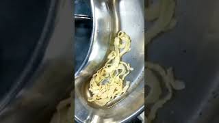 Tapeworm cestodes Surgical Removal In A Patient  Informative Video [upl. by Eiramnerual]