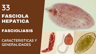 FASCIOLA HEPÁTICA 33  FASCIOLIASIS  TREMATODOS [upl. by Cirre]