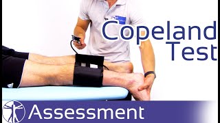 Copeland Test  Achilles Tendon Rupture [upl. by Kantos]