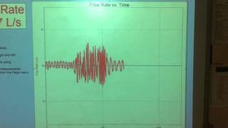 B22 Changes in tidal volume and ventilation rate [upl. by Atterrol]